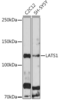 Anti-LATS1 Antibody (CAB17992)