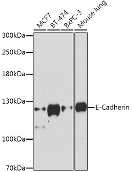 Anti-E-Cadherin Antibody (CAB11492)