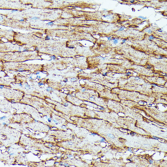 Anti-SLC14A1 Antibody (CAB15991)