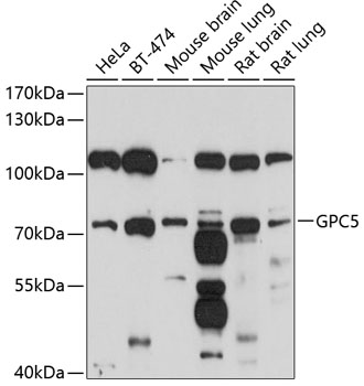 Anti-GPC5 Antibody (CAB10411)