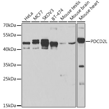 Anti-PDCD2L Antibody (CAB7394)