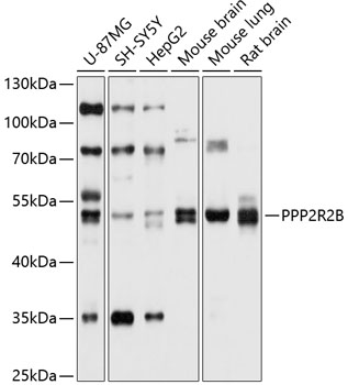 Anti-PPP2R2B Antibody (CAB10494)