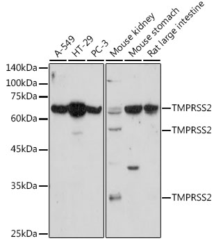 Anti-TMPRSS2 Antibody (CAB1979)