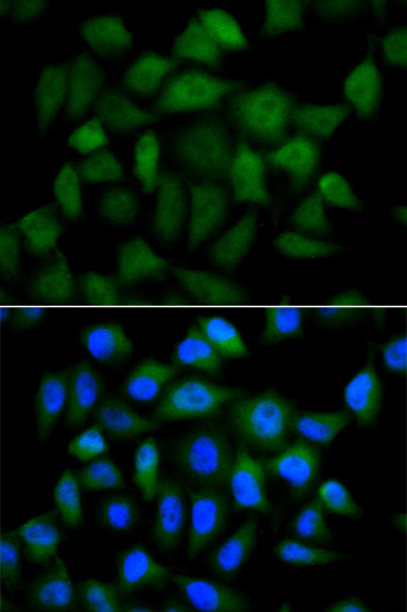 Anti-AFP Antibody (CAB0200)