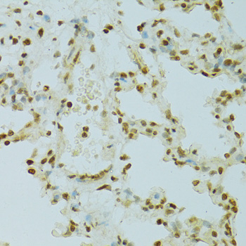 Anti-RCC1 Antibody (CAB6350)