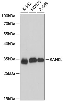 Anti-RANKL Antibody (CAB16326)