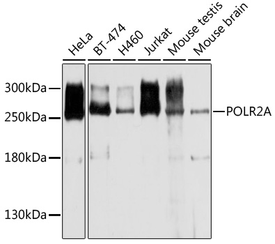 Anti-POLR2A Antibody (CAB11181)