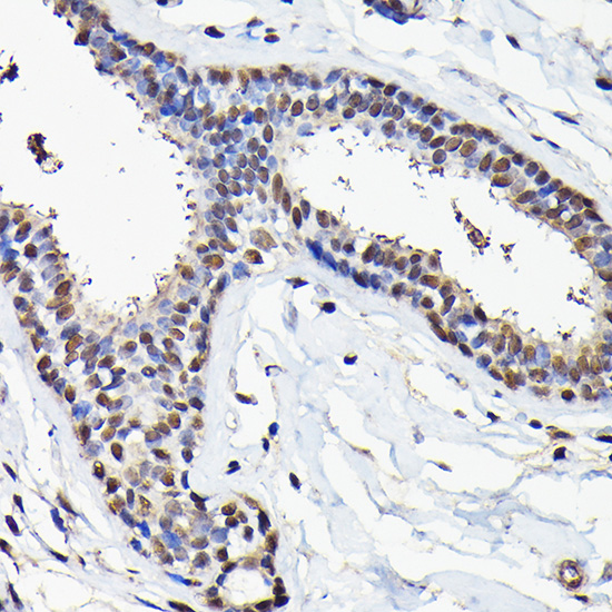 Anti-EIF5A Antibody (CAB2016)