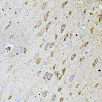 Anti-ND5 Polyclonal Antibody (CAB8135)