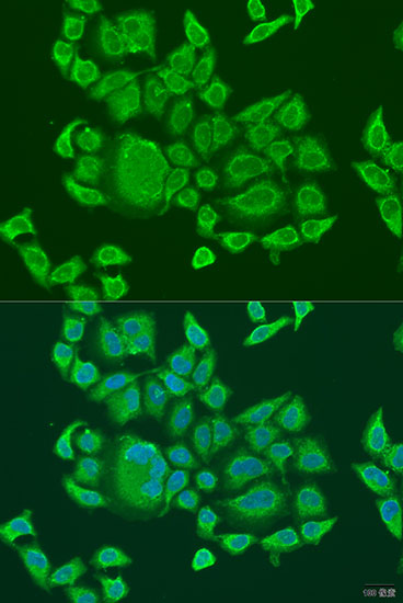 Anti-DHX58 Polyclonal Antibody (CAB8257)