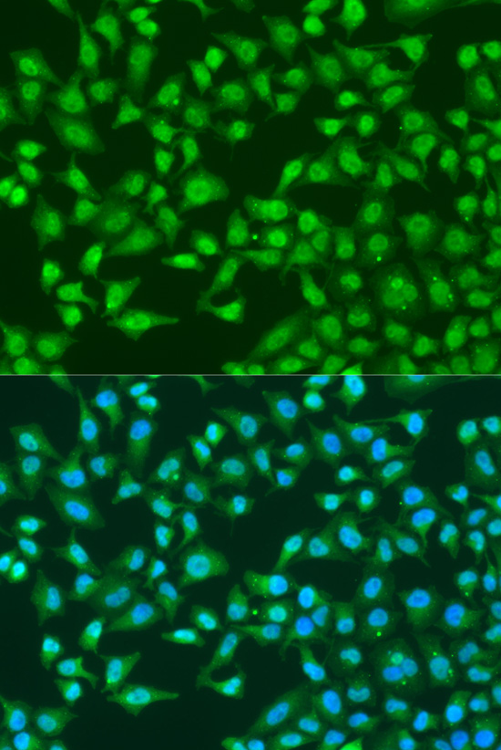 Anti-TARDBP Antibody (CAB0538)