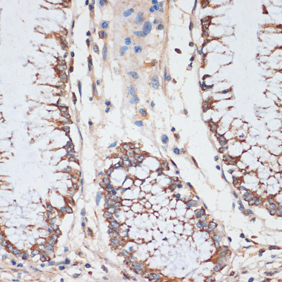 Anti-CDK4 Antibody (CAB0366)