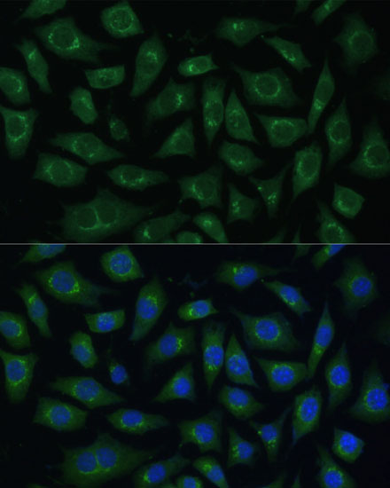 Anti-ARL1 Antibody (CAB15254)