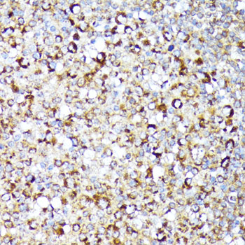 Anti-RIPK1 Antibody (CAB7414)