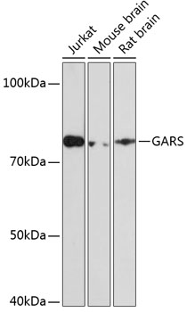 Anti-GARS Antibody