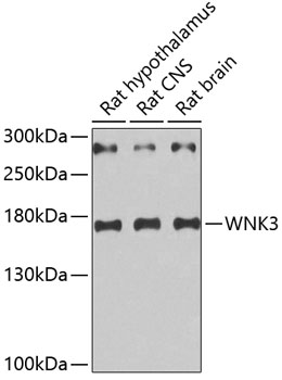 Anti-WNK3 Antibody (CAB5574)