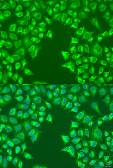 Anti-LRP6 Antibody (CAB15070)