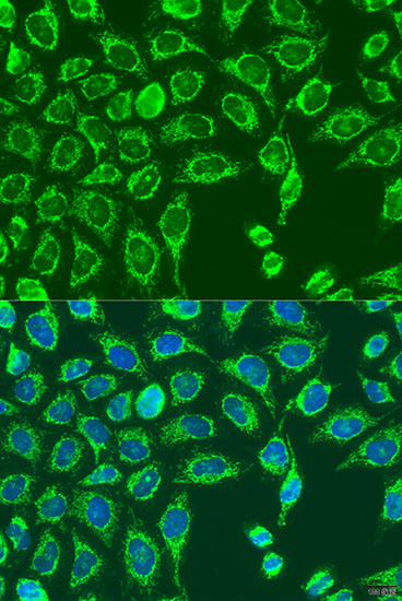 Anti-MATN3 Antibody (CAB15072)