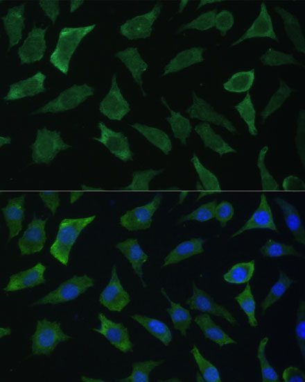 Anti-ECE1 Antibody [KO Validated] (CAB5638)