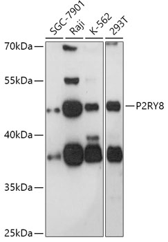 Anti-P2RY8 Antibody (CAB17850)