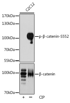 Anti-Phospho-CTNNB1-S552 Antibody (CABP0579)