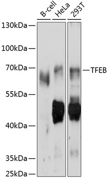 Anti-TFEB Antibody (CAB11796)