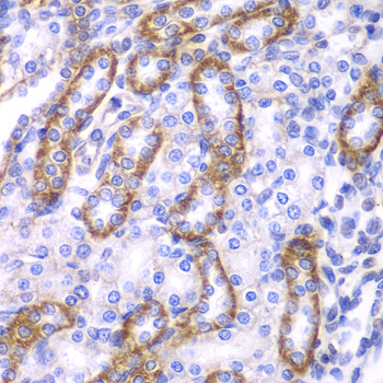 Anti-ARRB1 Antibody (CAB0190)