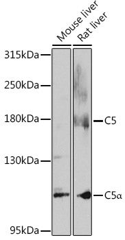 Anti-Complement C5 Polyclonal Antibody (CAB8104)