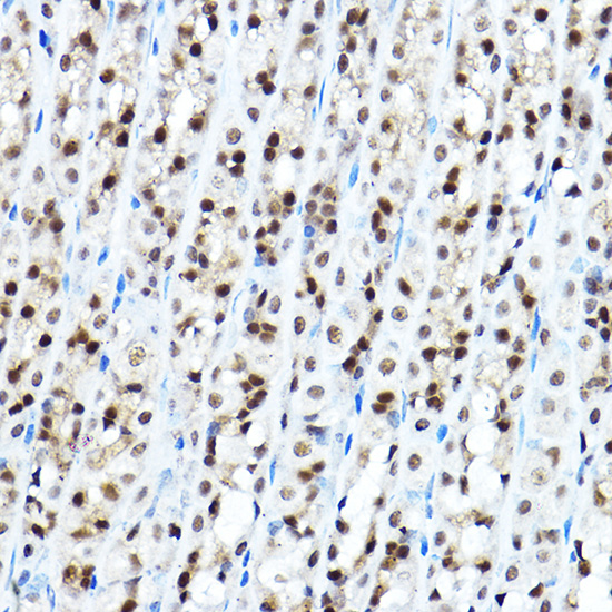 Anti-FOXA1 Antibody (CAB15278)