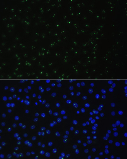 Anti-DDX50 Polyclonal Antibody (CAB8628)