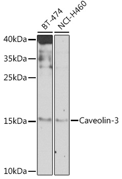 Anti-Caveolin-3 Polyclonal Antibody (CAB8089)