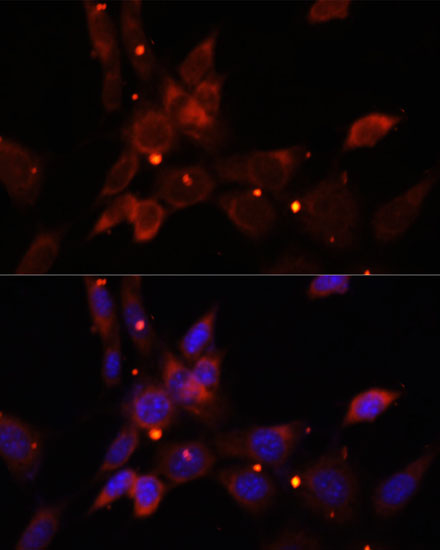 Anti-IKKEpsilon Antibody (CAB0244)