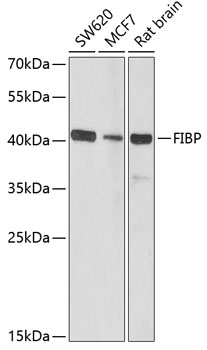 Anti-FIBP Antibody (CAB6436)