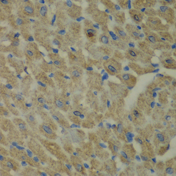 Anti-CCBL1 Antibody (CAB6542)