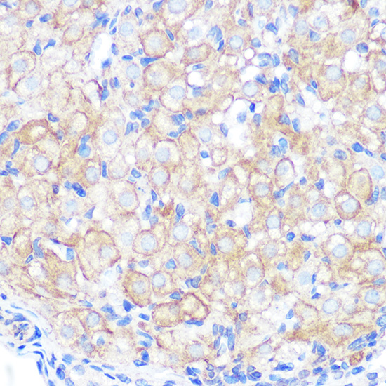 Anti-Occludin Antibody (CAB2601)