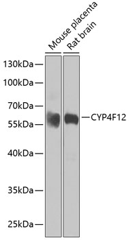 Anti-CYP4F12 Polyclonal Antibody (CAB7993)