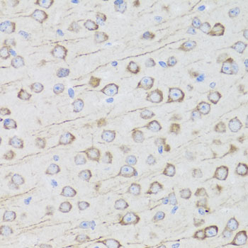 Anti-MIP Antibody (CAB2886)