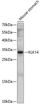 Anti-KLK14 Antibody (CAB10767)