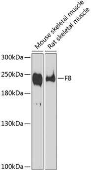 Anti-F8 Antibody (CAB1366)