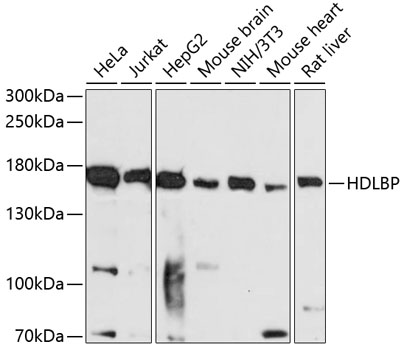 Anti-HDLBP Antibody (CAB6028)