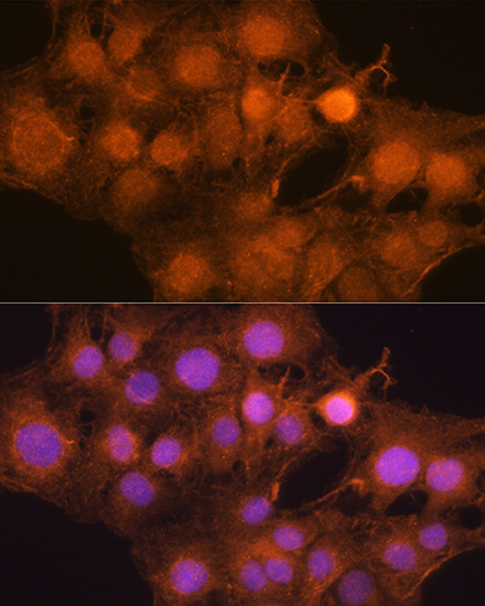 Anti-MDM2 Antibody (CAB13327)