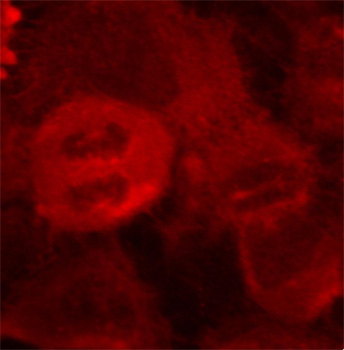 Anti-Phospho-MAP2K2-T394 Antibody (CABP0121)