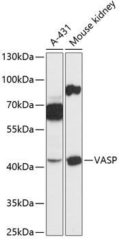 Anti-VASP Antibody (CAB14217)