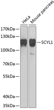 Anti-SCYL1 Antibody (CAB6735)