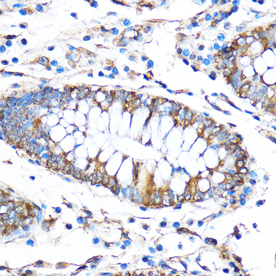 Anti-FoxO3a Antibody (CAB0102)