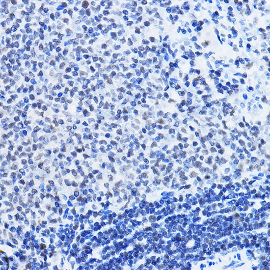 Anti-HDAC1 Antibody [KO Validated] (CAB0238)