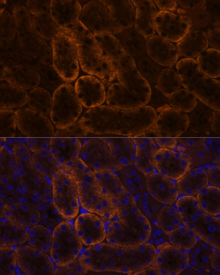 Anti-SLC14A1 Antibody (CAB15991)