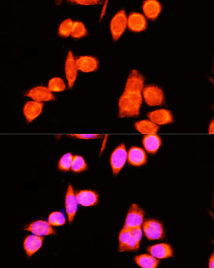 Anti-DNAJC19 Antibody (CAB5146)