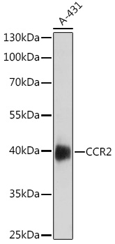 Anti-CCR2 Antibody (CAB18136)