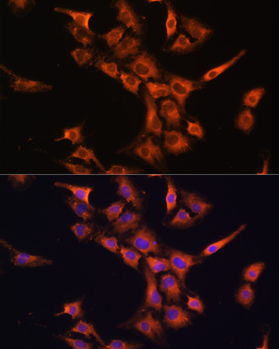 Anti-PFDN5 Antibody (CAB4014)